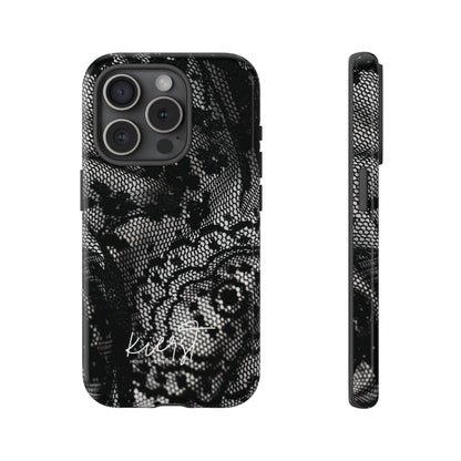Black + White Lace Print iPhone Case
